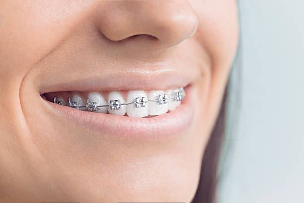 Best Teeth Whitening  in Dianapolis, IN